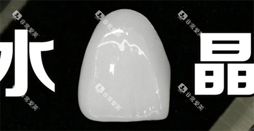 水晶瓷贴面
