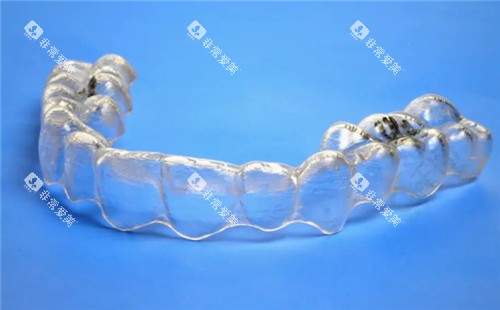 隐形牙套单幅照片 隐形牙套单幅照片