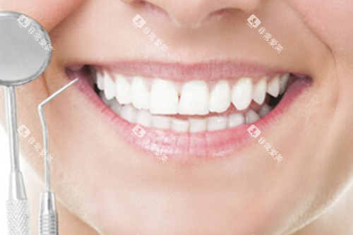 牙齿检查宣传示意图 牙齿检查宣传示意图