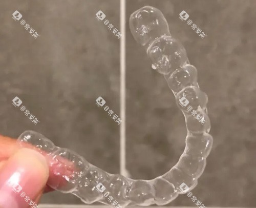 隐形牙齿矫正器 隐形牙齿矫正器