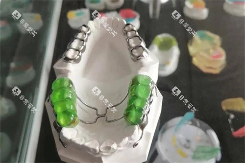 反颌牵引器实物展示图