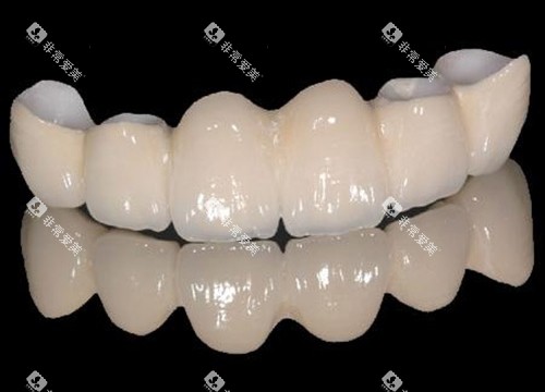 半口全瓷牙展示图