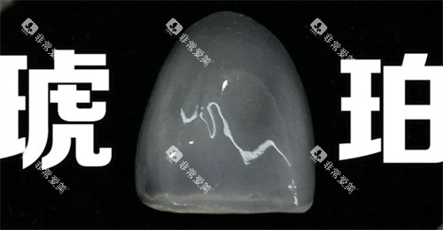 琥珀瓷贴面