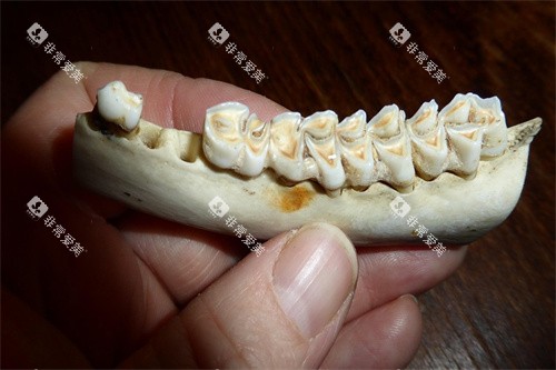 假牙模型展示