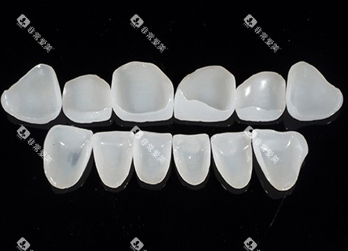牙齿贴面玻璃陶瓷材料 牙齿贴面玻璃陶瓷材料