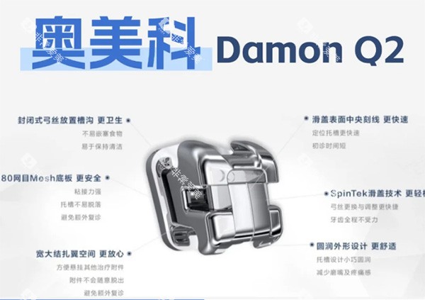 奥美科DamonQ2金属自锁牙套