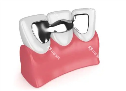 马里兰桥是什么