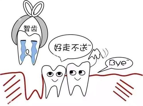 拔智齿示意图 拔智齿示意图