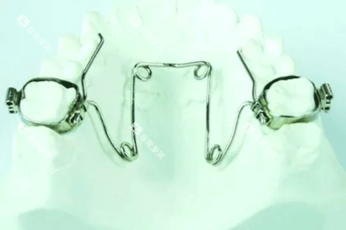 牙齿扩弓器图 牙齿扩弓器图