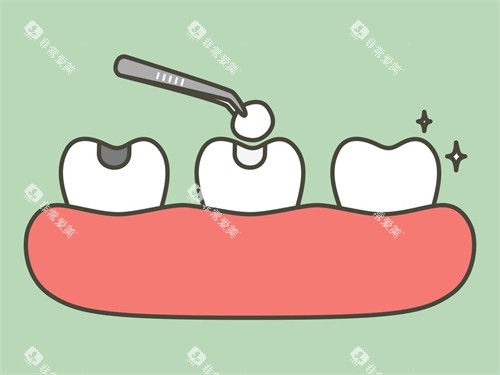 补牙漫画图示意图 补牙漫画图示意图