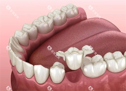 马里兰桥多少钱