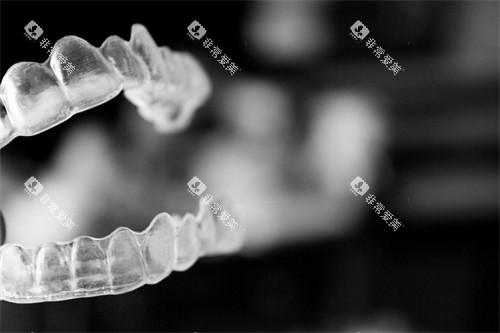 隐形矫正牙套实物展示图