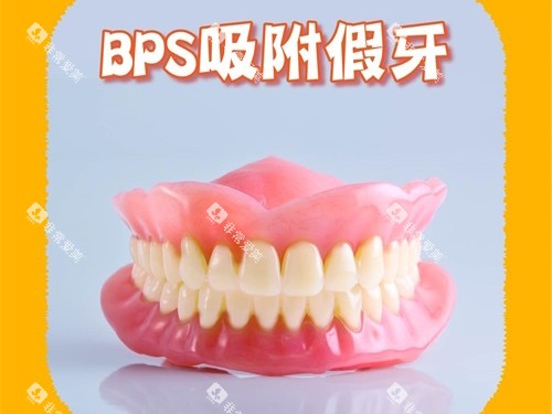 BPS吸附性义齿模型图