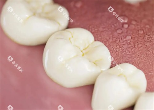 没有正确刷牙的牙齿