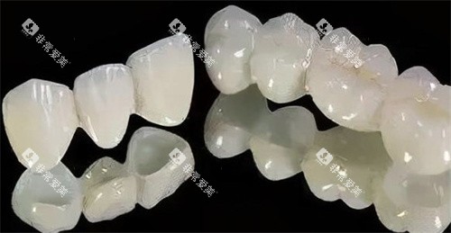 二氧化锆全瓷牙