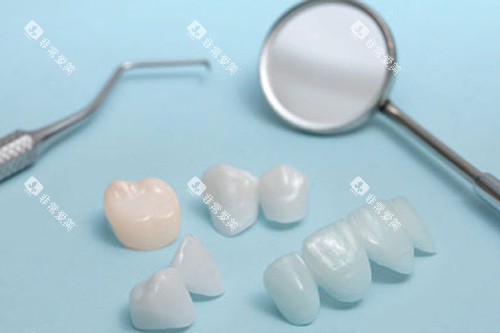 全瓷牙展示图 全瓷牙展示图