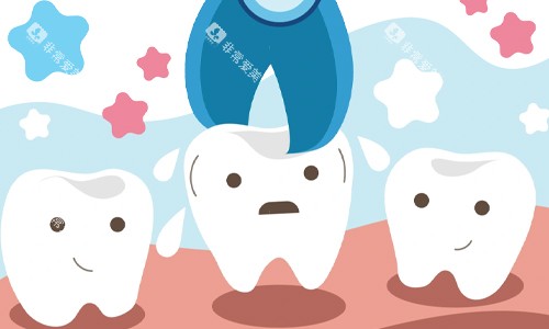 拔牙展示图 拔牙展示图