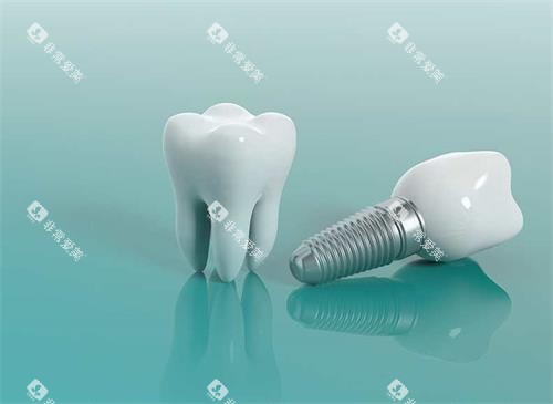 种植牙模具示意图 种植牙模具示意图