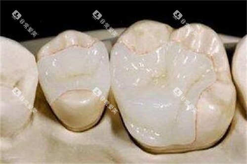 牙齿修复改善照片图