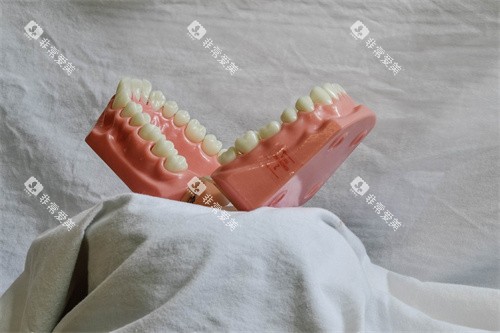 牙齿材料展示图
