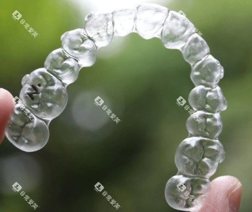 隐形牙套示意图 隐形牙套示意图