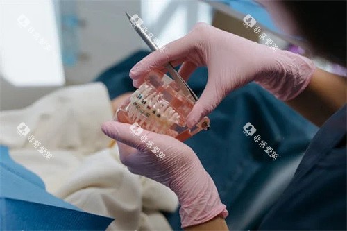 正畸模型示意图