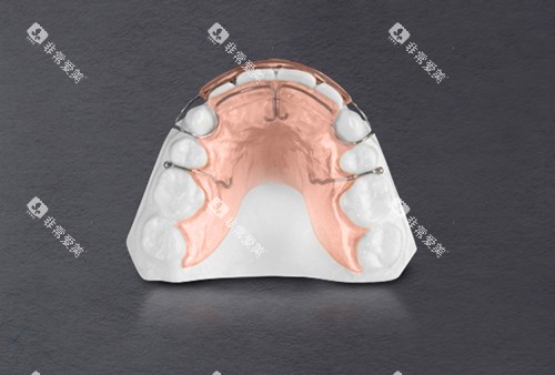 法兰克矫正器示意图 法兰克矫正器示意图