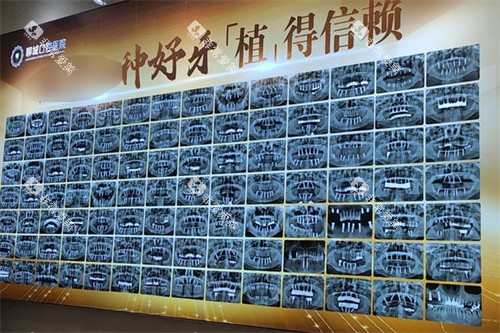 聊城口腔医院照片墙