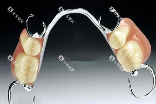 多颗活动义齿示意图 多颗活动义齿示意图