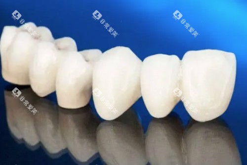 爱尔创全瓷牙模型图