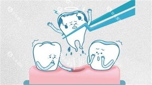 牙齿拔除卡通示意图 牙齿拔除卡通示意图