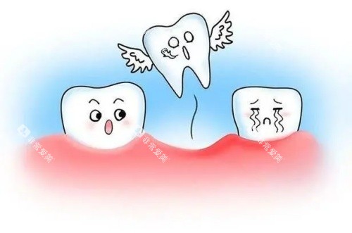 牙齿脱落示意图