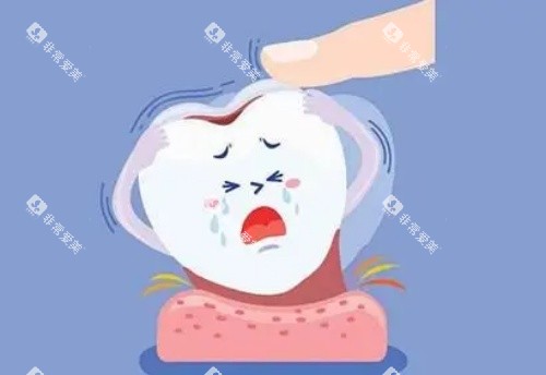 单颗牙齿漫画示意图 单颗牙齿漫画示意图