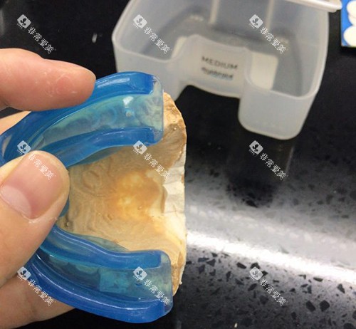 牙齿矫正MRC早期肌功能矫正器石膏模型试戴 牙齿矫正MRC早期肌功能矫正器石膏模型试戴