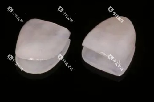 牙贴面材料卡通图