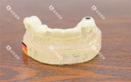 牙齿模具照片