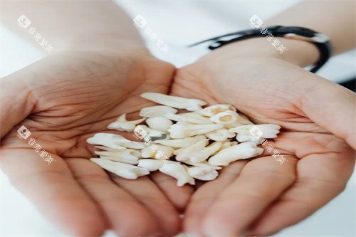 牙齿修复材料