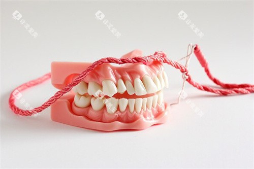 排龈线假牙模型