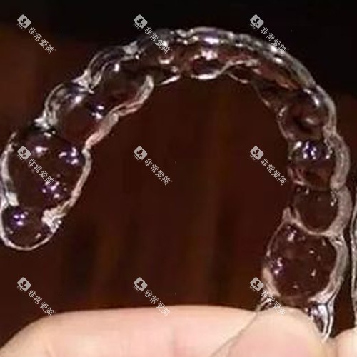 隐形透明牙套图示展示