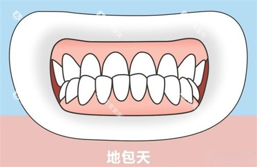 地包天正面演示动画图