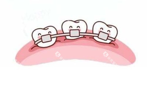 畸形牙齿矫正卡通图