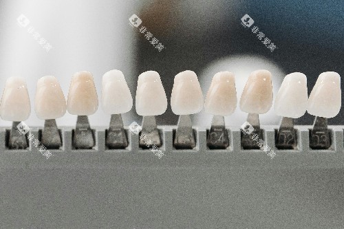 牙齿贴面色号