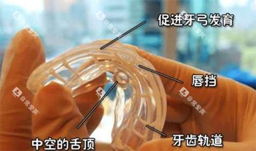 矫治器材料解析