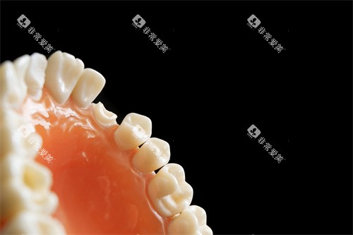 牙齿修复图示