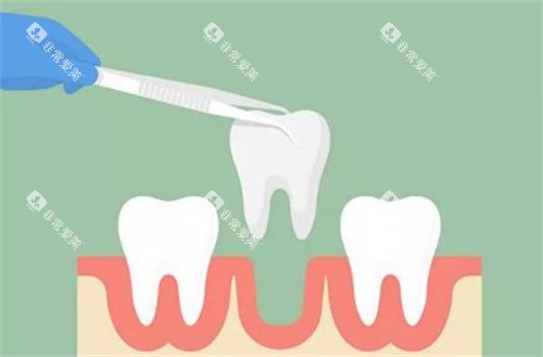 牙齿拔除改善图 牙齿拔除改善图