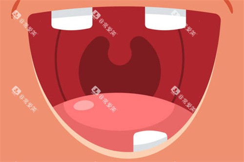 缺牙动画