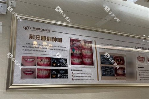 广州暨博口腔展示墙 广州暨博口腔展示墙