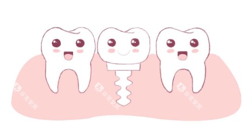 种植牙动画图 种植牙动画图