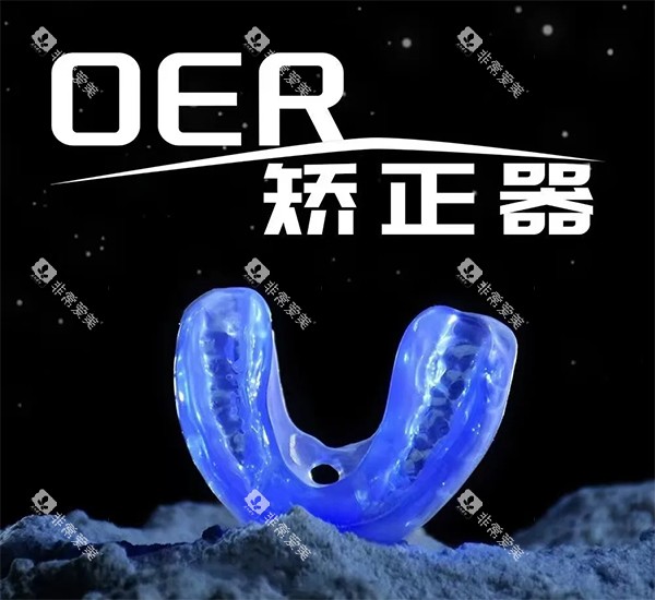 oer矫正器怎么样好不好