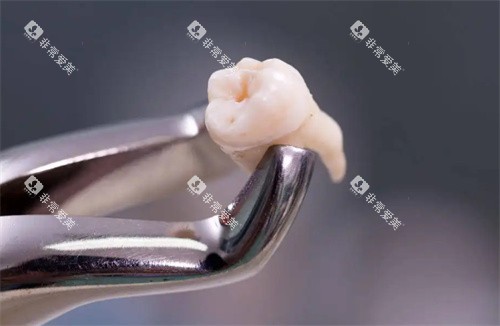 拔掉的牙齿照片